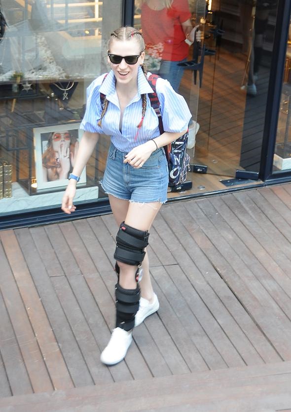 Serenay Sarıkaya'nın bacağına ne oldu?