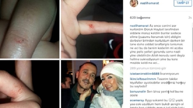 Nazlı Hamarat sevgilisinden dayak yedi!